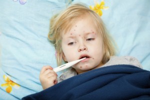 A young girl lies in bed with a thermometer in her mouth. She has red spots covering her face.