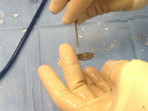 Joseph Vettukattil, MD, shows off a stent.