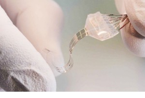 A soft spinal cord implant is shown.