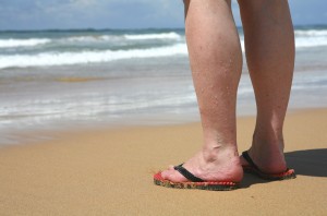 A person stands near the beach. Their legs are veiny.