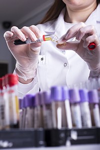 A medical professional examines a urine sample to detect kidney cancer.