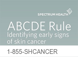 "ABCDE Rule. Identify early signs of skin cancer. 1-855-SHCANCER"