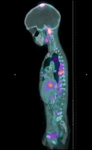 A CT scan image is shown.