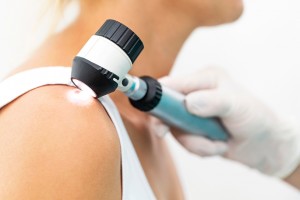A woman gets tested for melanoma by a medical professional.