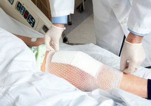 A person lies in a hospital bed after an arthroscopic knee surgery.