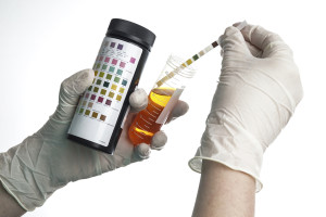 A urine test is shown.