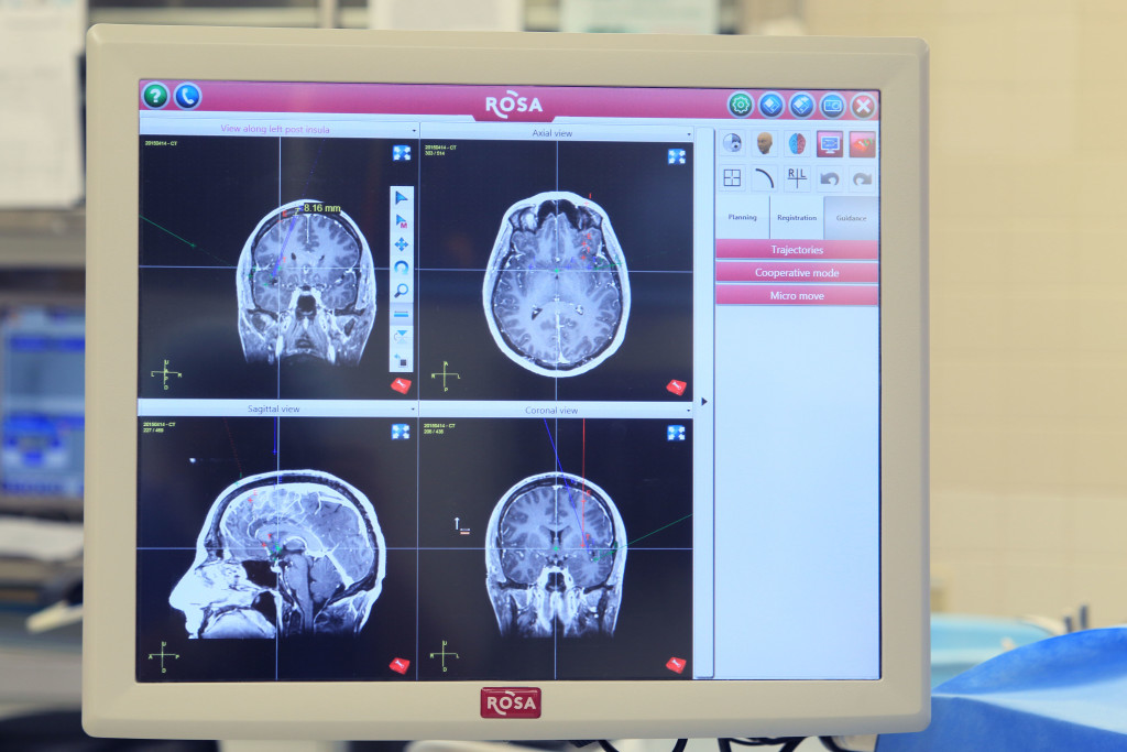 A monitor shows four MRI images of a brain.