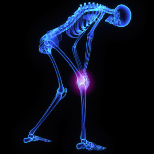 An illustration of a person holding their knee due to knee pain.