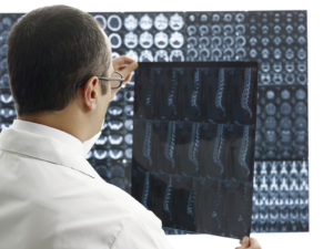 A medical professional looks at MRI images.