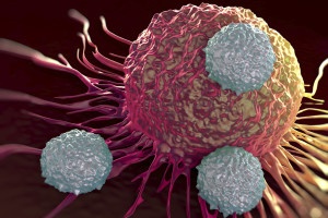 Researchers have found “extraordinary” success by manipulating immune cells to target acute lymphoblastic leukemia.