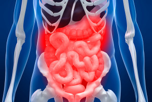 An illustration of a person's colon is shown.