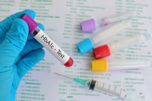 A person wears medical gloves as they hold a test tube labeled, "HbA1c - Test."