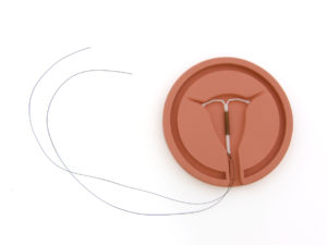 An IUD is in focus.