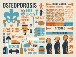 An infographic contains information about osteoporosis. The infographic suggestions to create healthy habits such as increasing exercise, calcium and vitamin D intake.