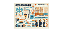 Keep osteoporosis at bay with exercise, calcium, vitamin D and other healthy habits. (For Spectrum Health Beat)
