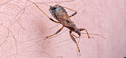 Chagas disease