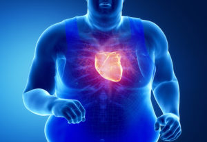 An illustration of an obese adult is in focus. Their heart is colored red to symbolize damage.
