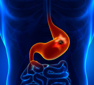 An illustration of a person's stomach is in focus. 