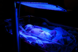 A baby wears goggles and is undergoing light therapy. A blue light shines on the baby.