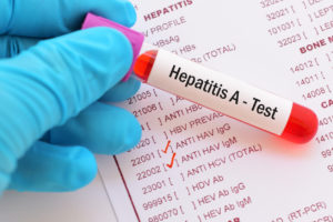 Get the facts on hepatitis A.