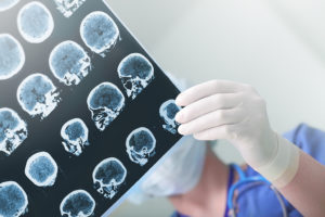 A medical professional looks through medical images of the brain.