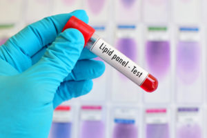 A gloved hand holds a test tube that reads, "Lipid panel - Test."