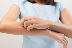 A woman scratches her arm.