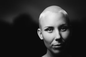 A black-and-white photo of a woman with no hair. She smiles slightly.