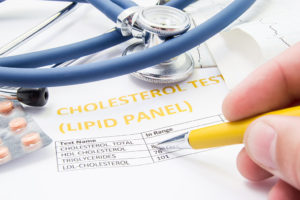 A piece of paper says, "Cholesterol Test (Lipid Panel)."