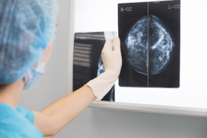 A medical professional looks at a medical image that appears to show breast cancer.