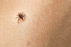 A tick sits on someone's skin.