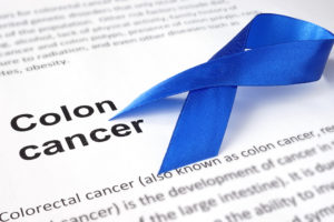The words "Colon Cancer" is shown next to a blue ribbon.