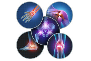 Medical images of bones are shown.