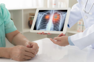 A doctor shows a patient a medical image of lungs with cancer.