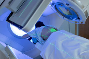 Radiation therapy that targets cancers in the chest area can tax the heart and trigger high levels of fatigue, breathing problems and a reduced ability to exercise, a new study suggests.